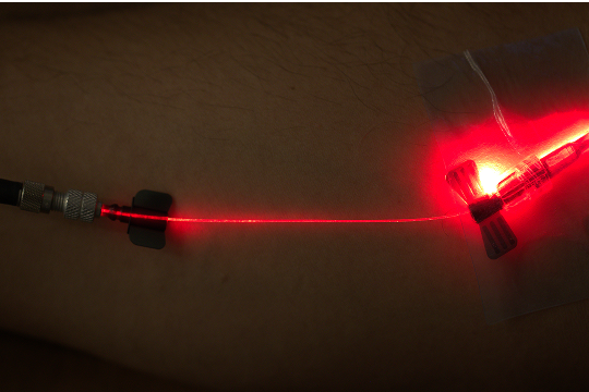 Microneedling with exosomes