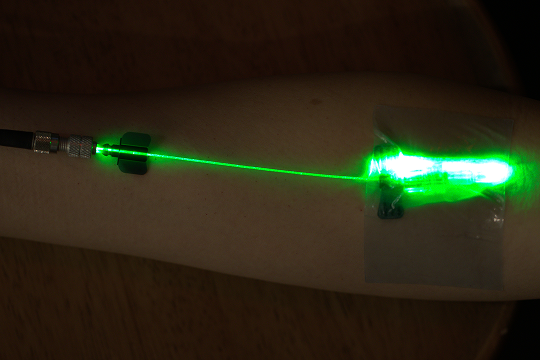 Microneedling with exosomes