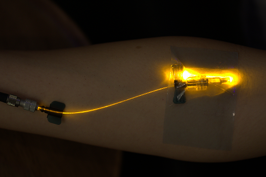 Microneedling with exosomes